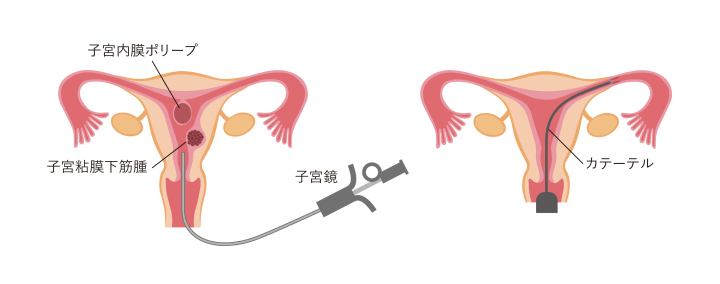 オプション検査イメージ