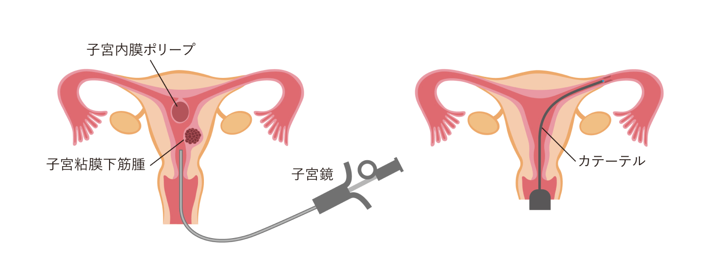 オプション検査イメージ