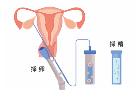 採卵・採精