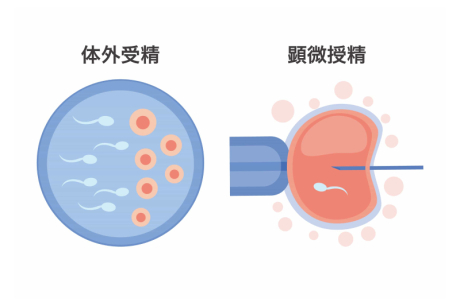 受精